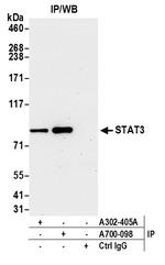STAT3 Antibody in Immunoprecipitation (IP)