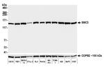 SMC3 Recombinant Rabbit Monoclonal Antibody (BLR099G)
