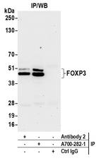 FOXP3 Antibody in Immunoprecipitation (IP)
