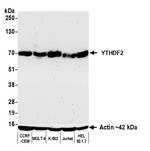 YTHDF2 Recombinant Rabbit Monoclonal Antibody (BLR297M)