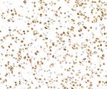 Cytokeratin 8 Antibody in Immunocytochemistry (ICC/IF)