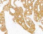 Cytokeratin 8 Antibody in Immunohistochemistry (Paraffin) (IHC (P))