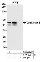 Cytokeratin 8 Antibody in Immunoprecipitation (IP)