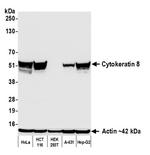 Cytokeratin 8 Antibody in Western Blot (WB)