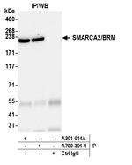 SMARCA2/BRM Antibody in Immunoprecipitation (IP)