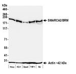 SMARCA2/BRM Recombinant Rabbit Monoclonal Antibody (BLR301M)