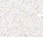 SMARCA2/BRM Antibody in Immunohistochemistry (Paraffin) (IHC (P))