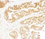 SMARCA2/BRM Antibody in Immunohistochemistry (Paraffin) (IHC (P))