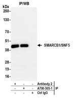 SMARCB1/SNF5 Antibody in Immunoprecipitation (IP)