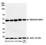 SMARCB1/SNF5 Antibody in Western Blot (WB)