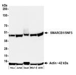 SMARCB1/SNF5 Recombinant Rabbit Monoclonal Antibody (BLR305M)