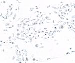 SMARCB1/SNF5 Antibody in Immunocytochemistry (ICC/IF)