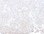 SMARCB1/SNF5 Antibody in Immunohistochemistry (Paraffin) (IHC (P))