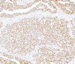SMARCB1/SNF5 Antibody in Immunohistochemistry (Paraffin) (IHC (P))