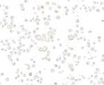 Nectin-3 Antibody in Immunocytochemistry (ICC/IF)