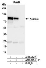Nectin-3 Antibody in Immunoprecipitation (IP)