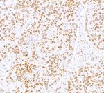 SRF Antibody in Immunohistochemistry (Paraffin) (IHC (P))