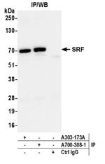 SRF Antibody in Immunoprecipitation (IP)