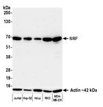 SRF Antibody in Western Blot (WB)