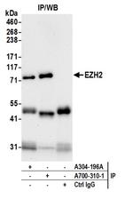 EZH2 Antibody in Immunoprecipitation (IP)