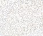 EZH2 Antibody in Immunohistochemistry (Paraffin) (IHC (P))