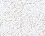 EZH2 Antibody in Immunohistochemistry (Paraffin) (IHC (P))