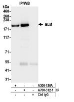 BLM Antibody in Immunoprecipitation (IP)