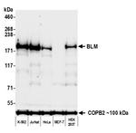 BLM Recombinant Rabbit Monoclonal Antibody (BLR312M)