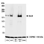 BLM Antibody in Western Blot (WB)