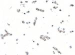 BLM Recombinant Rabbit Monoclonal Antibody (BLR313M)
