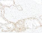 BLM Antibody in Immunohistochemistry (Paraffin) (IHC (P))
