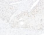 BLM Antibody in Immunohistochemistry (Paraffin) (IHC (P))