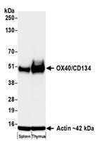 OX40/CD134 Recombinant Rabbit Monoclonal Antibody (BLR314M)