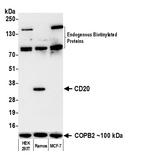 Biotin Antibody in Western Blot (WB)
