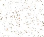 BAF57/SMARCE1 Antibody in Immunocytochemistry (ICC/IF)