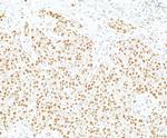 BAF57/SMARCE1 Antibody in Immunohistochemistry (Paraffin) (IHC (P))