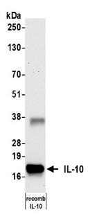 IL-10 Antibody in Western Blot (WB)