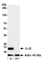 IL-10 Antibody in Western Blot (WB)