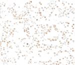 p16INK4a Recombinant Rabbit Monoclonal Antibody (BLR318M)