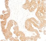 p16INK4a Antibody in Immunohistochemistry (Paraffin) (IHC (P))