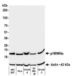 p16INK4a Antibody in Western Blot (WB)