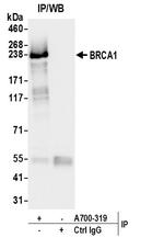 BRCA1 Antibody in Immunoprecipitation (IP)