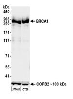 BRCA1 Antibody in Western Blot (WB)