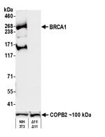 BRCA1 Recombinant Rabbit Monoclonal Antibody (BLR319M)