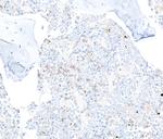 CD22 Antibody in Immunohistochemistry (Paraffin) (IHC (P))