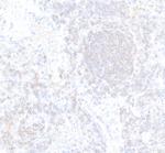 CD22 Antibody in Immunohistochemistry (Paraffin) (IHC (P))