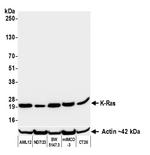 K-Ras Recombinant Rabbit Monoclonal Antibody (BLR321M)