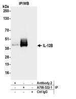 IL-12B Antibody in Immunoprecipitation (IP)