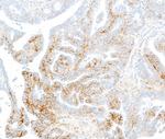 CD138 Antibody in Immunohistochemistry (Paraffin) (IHC (P))
