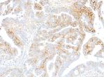 CD138 Antibody in Immunohistochemistry (Paraffin) (IHC (P))